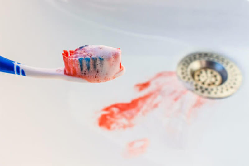 Зубная щетка с кровоподтеками